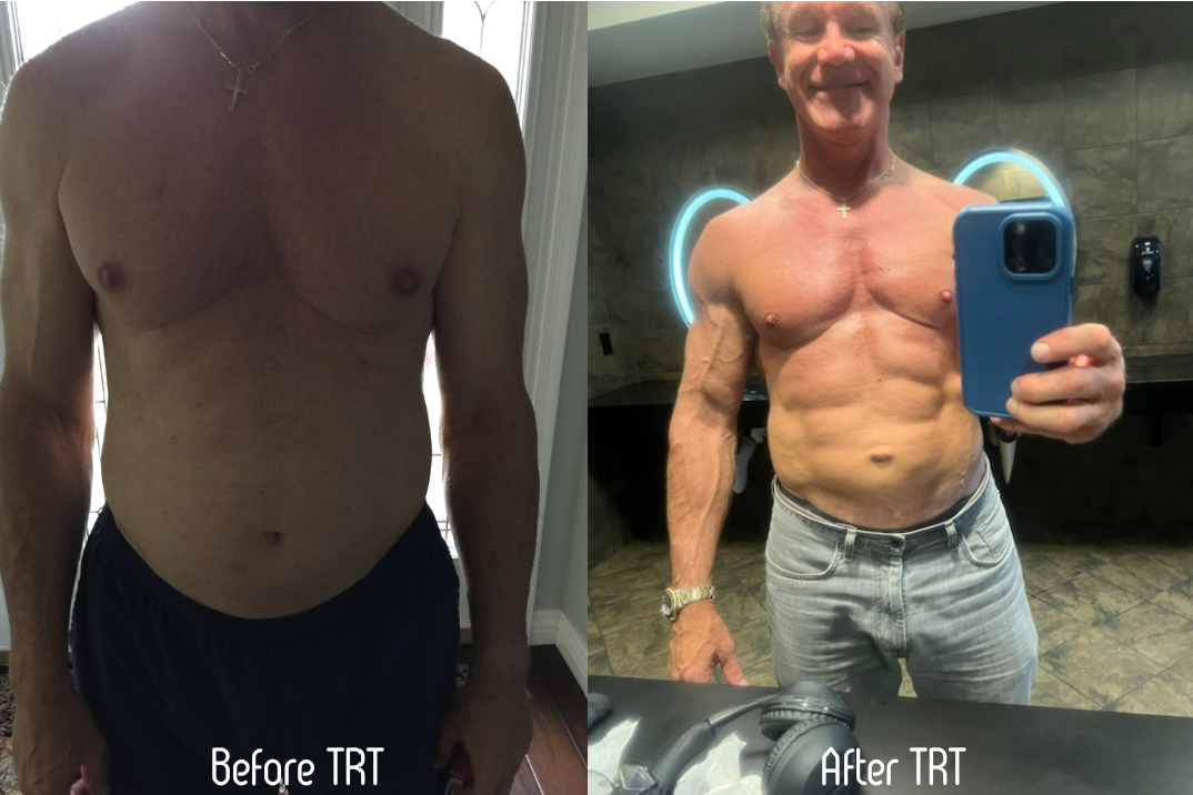 Trt And Hgh Before And After Testosterone therapy - Eastshore Healthcare